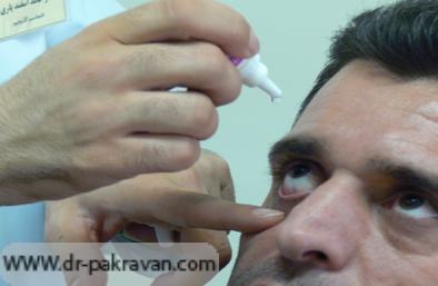 طریقه مصرف انواع قطره‌های چشمی از جمله اشک مصنوعی